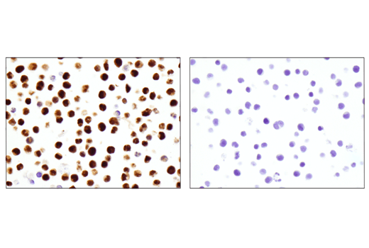 Immunohistochemistry Image 3: IRF-4 (E8H3S) XP<sup>®</sup> Rabbit mAb (BSA and Azide Free)