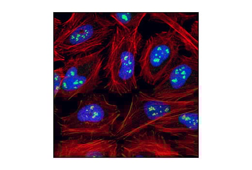 Immunofluorescence Image 1: Fibrillarin (C13C3) Rabbit mAb