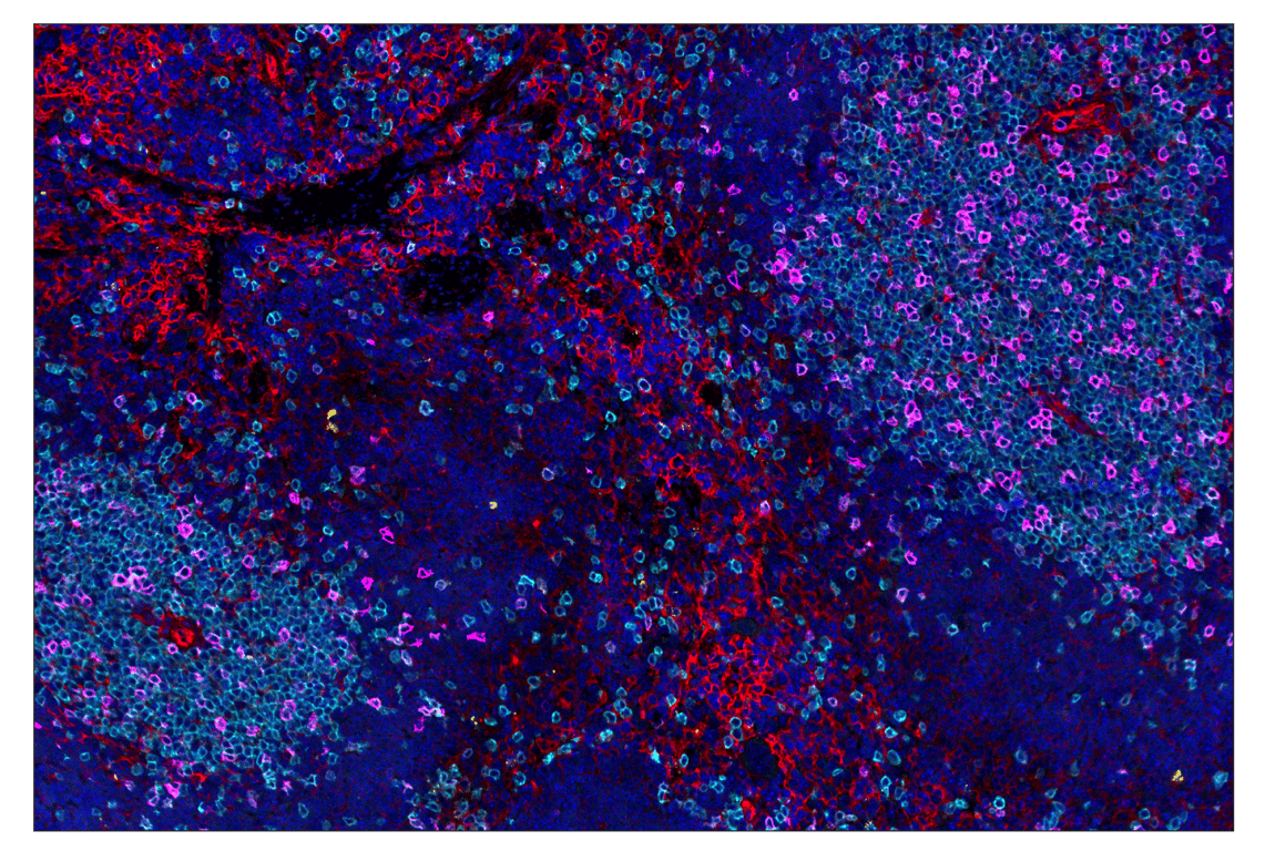 Immunohistochemistry Image 1: IL-2Rα/CD25 (E9W2J) & CO-0074-488 SignalStar<sup>™</sup> Oligo-Antibody Pair