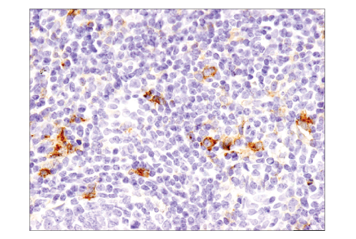 Immunohistochemistry Image 3: TIM-3 (D5D5R<sup>™</sup>) XP<sup>®</sup> Rabbit mAb (BSA and Azide Free)