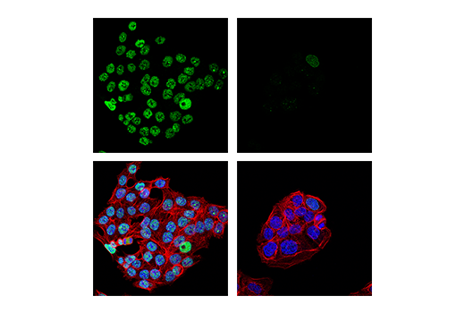 Immunofluorescence Image 1: 53BP1 (E7N5D) XP<sup>®</sup> Rabbit mAb (BSA and Azide Free)