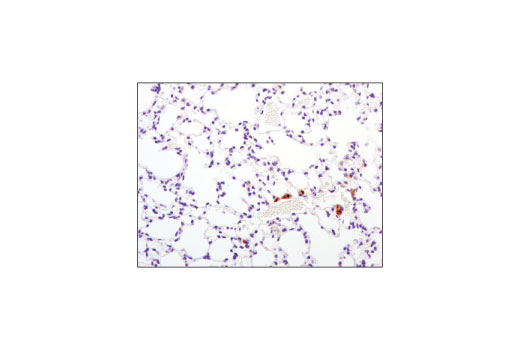 Immunohistochemistry Image 1: TIM-3 (D3M9R) XP<sup>®</sup> Rabbit mAb