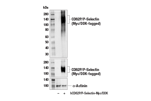 Western Blotting Image 2: CD62P/P-Selectin (E8Q1W) XP<sup>®</sup> Rabbit mAb (BSA and Azide Free)