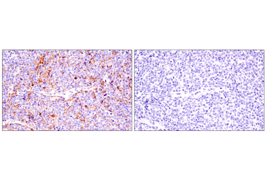 Immunohistochemistry Image 3: CD21/CR2 (2G9) Mouse mAb