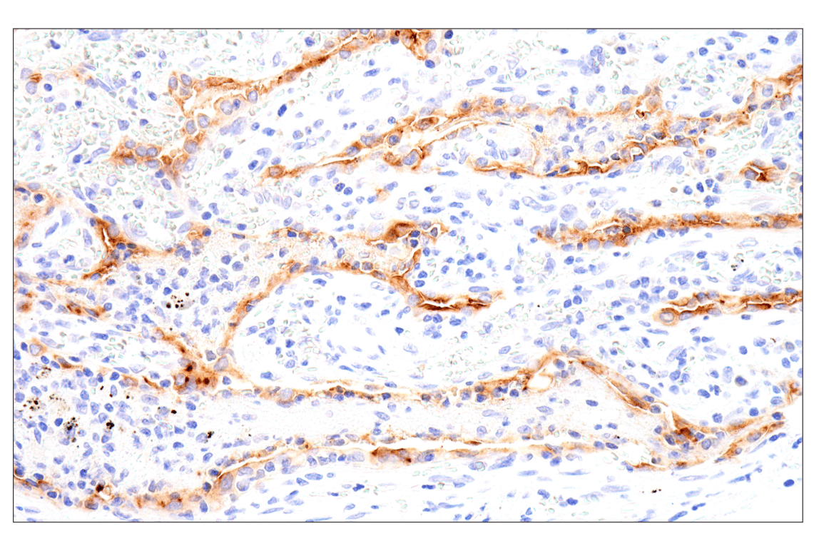 Immunohistochemistry Image 1: Folate Receptor Alpha/FOLR1 (BN3.2) Mouse mAb