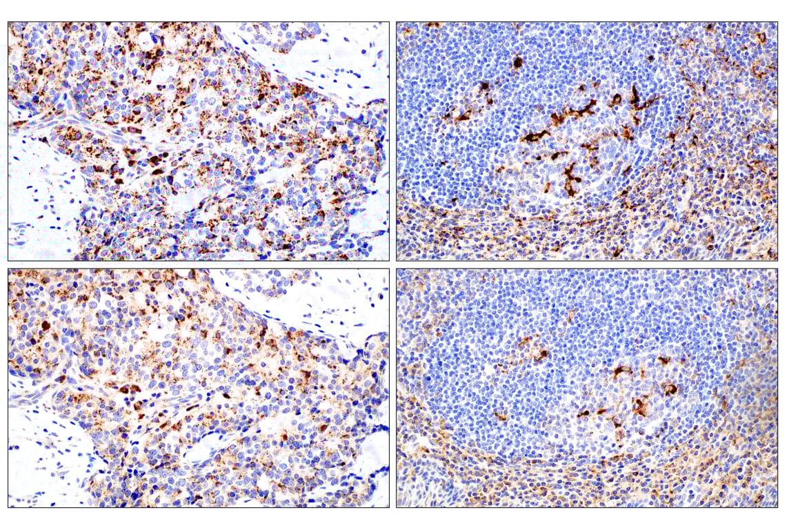 Immunohistochemistry Image 11: Cathepsin D (E5V4H) Rabbit mAb