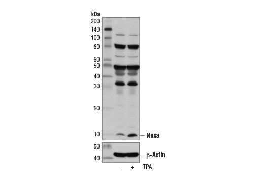 undefined Image 12: Pro-Apoptosis Bcl-2 Family Antibody Sampler Kit II