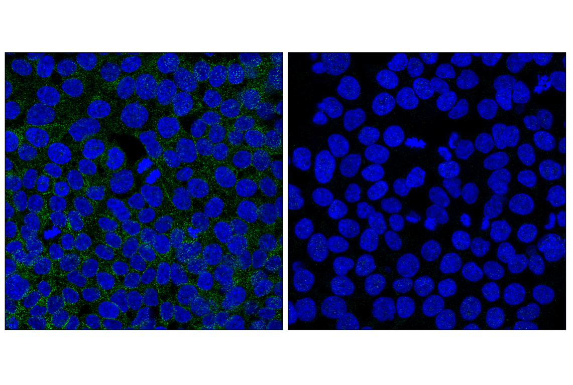 Immunofluorescence Image 2: Numb (C29G11) Rabbit mAb