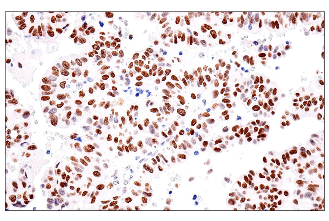 Immunohistochemistry Image 11: FoxA1/HNF3α (IHC578) Mouse mAb