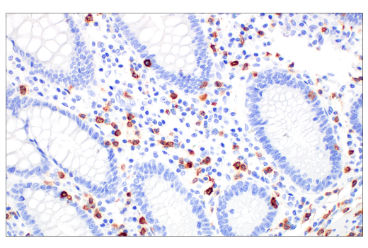 Immunohistochemistry Image 1: CD7 (E4G1Q) XP<sup>®</sup> Rabbit mAb (BSA and Azide Free)