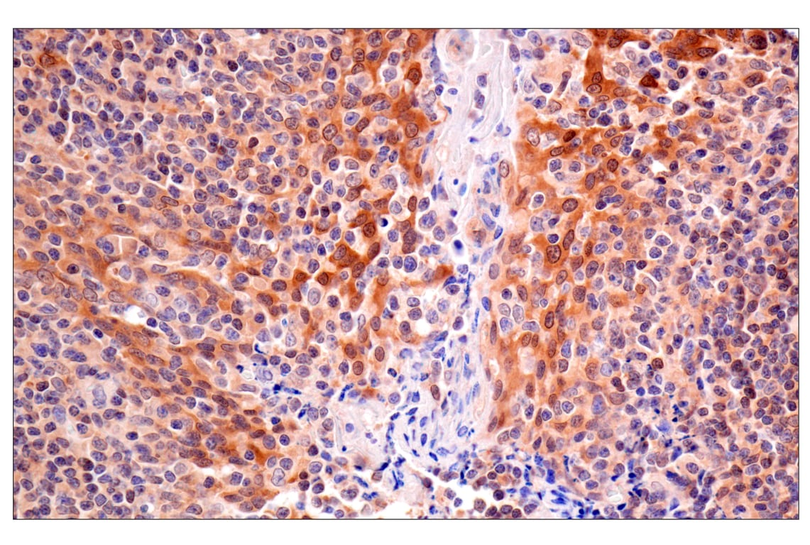 Immunohistochemistry Image 5: ACBP/DBI (E6K8G) XP<sup>®</sup> Rabbit mAb