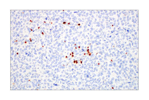 Immunohistochemistry Image 10: T-bet/TBX21 (E4I2K) Rabbit mAb