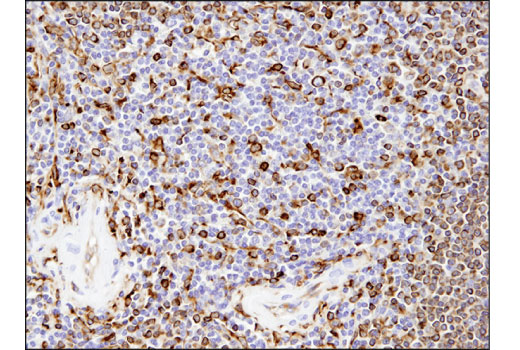 Immunohistochemistry Image 1: CD74 (D5N3I) XP<sup>®</sup> Rabbit mAb (BSA and Azide Free)