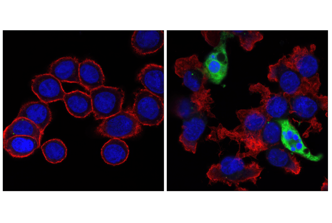 Immunofluorescence Image 1: Cleaved Caspase-3 (Asp175) (5A1E) Rabbit mAb (BSA and Azide Free)