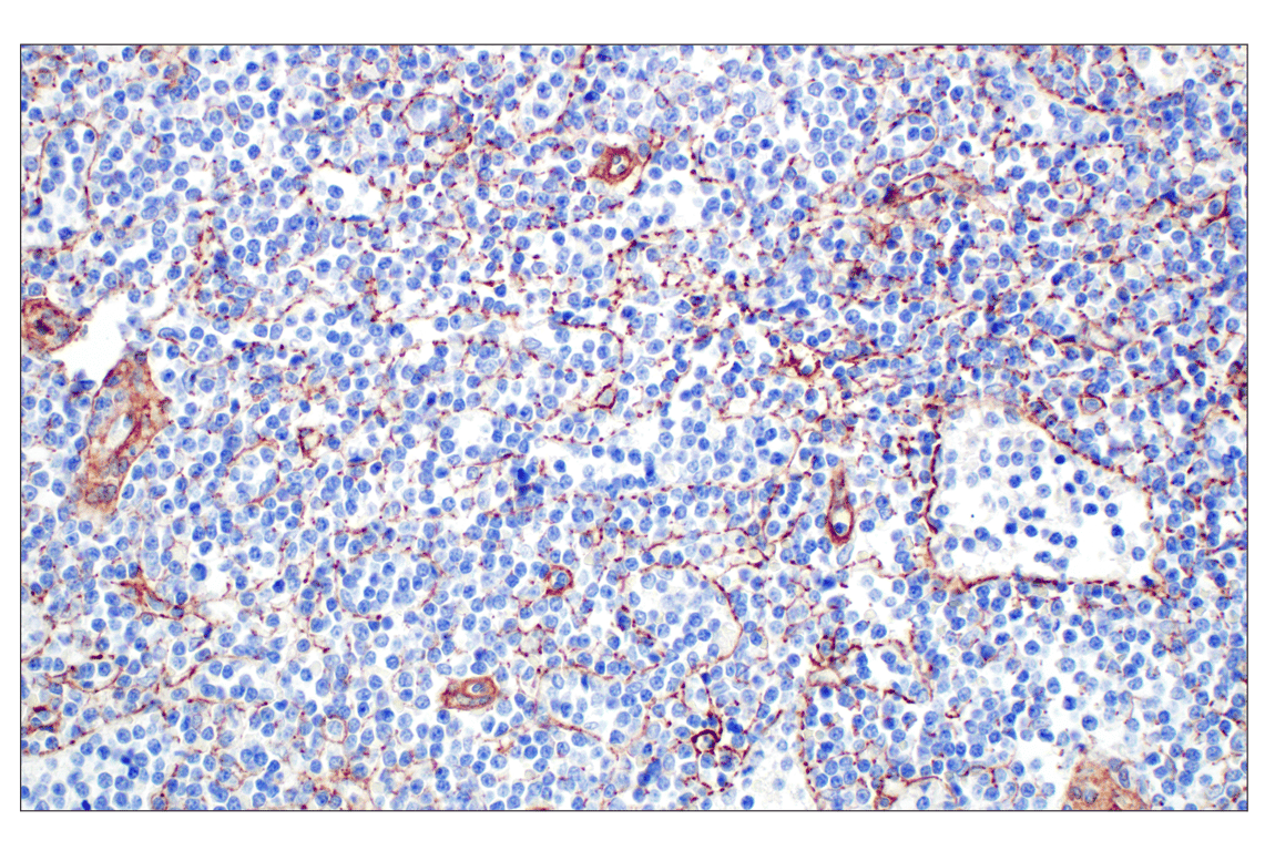 Immunohistochemistry Image 3: COL4A1 (E5M6R) Rabbit mAb (IHC Formulated)