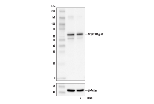 Western Blotting Image 4: SQSTM1/p62 (D6M5X) Rabbit mAb