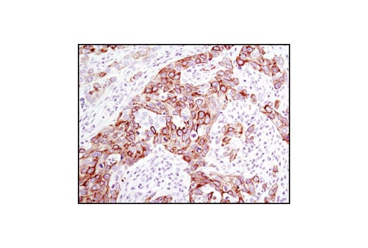 Immunohistochemistry Image 2: Keratin 17/19 (D32D9) XP<sup>®</sup> Rabbit mAb (BSA and Azide Free)