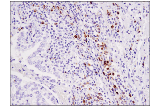 undefined Image 45: Human Exhausted CD8<sup>+</sup> T Cell IHC Antibody Sampler Kit