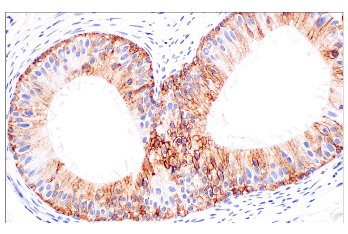 Immunohistochemistry Image 9: TACSTD2/TROP2 (F4W4J) Rabbit mAb (BSA and Azide Free)