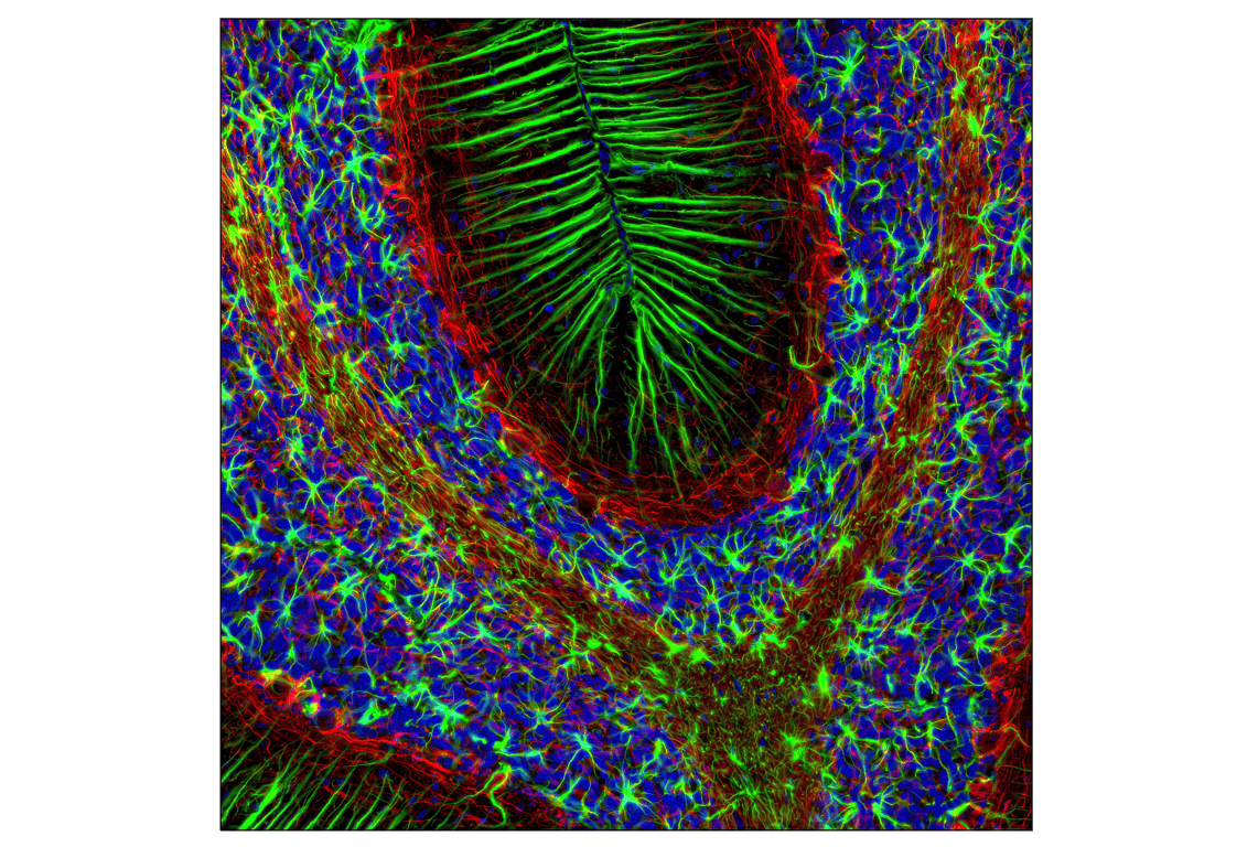 Immunofluorescence Image 1: GFAP (GA5) Mouse mAb (Alexa Fluor® 488 Conjugate)