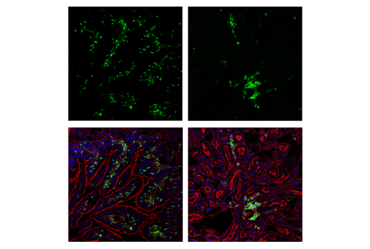 Immunofluorescence Image 1: CD45 (D3F8Q) Rabbit mAb (Alexa Fluor<sup>®</sup> 488 Conjugate)