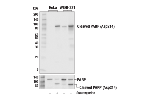 Western Blotting Image 1: Cleaved PARP (Asp214) Antibody