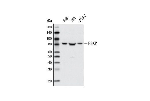 Western Blotting Image 1: PFKP Antibody