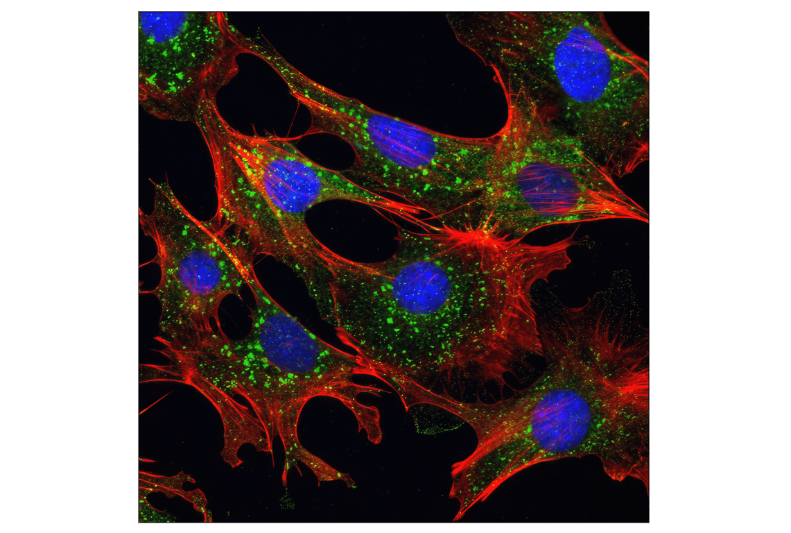 undefined Image 39: TREM2-dependent mTOR Metabolic Fitness Antibody Sampler Kit