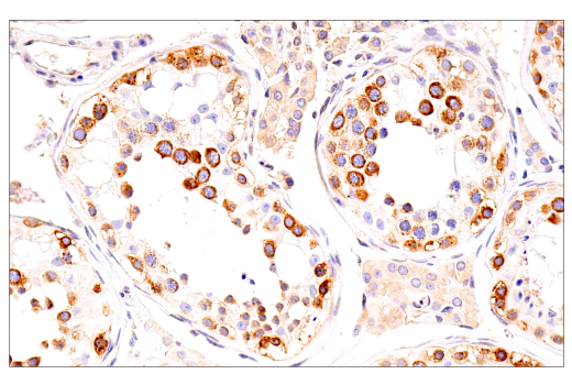 Immunohistochemistry Image 9: G3BP1 (E9G1M) XP<sup>®</sup> Rabbit mAb