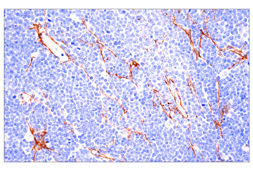 Immunohistochemistry Image 5: COL1A1 (E8F4L) XP<sup>®</sup> Rabbit mAb (BSA and Azide Free)