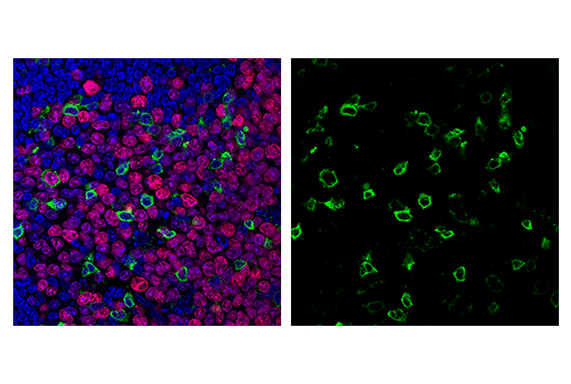 Immunofluorescence Image 1: PD-1 (Intracellular Domain) (D7D5W) XP<sup>®</sup> Rabbit mAb (Alexa Fluor<sup>®</sup> 488 Conjugate)