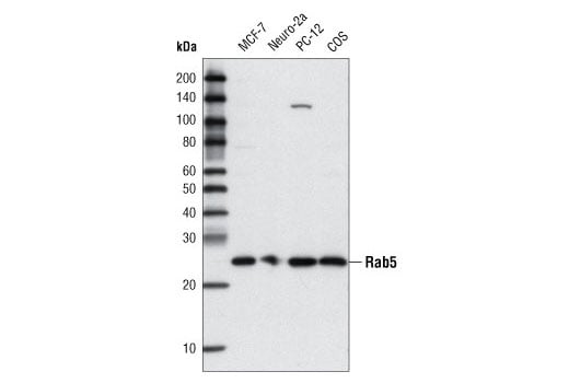 undefined Image 7: LRP1-mediated Endocytosis and Transmission of Tau Antibody Sampler Kit