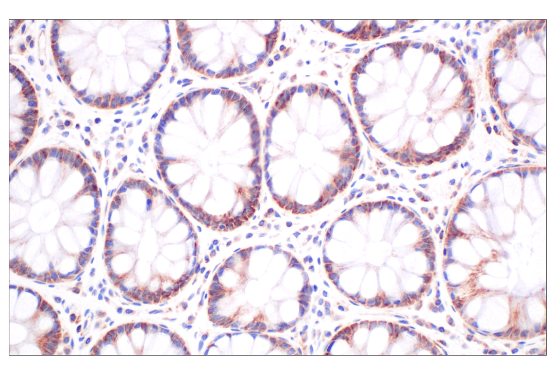 Immunohistochemistry Image 7: CPT1A (E3Y1V) Rabbit mAb