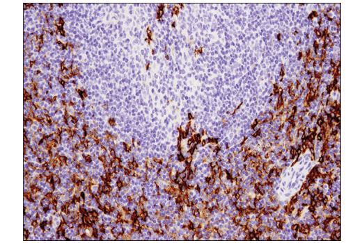 undefined Image 51: Mouse Reactive M1 vs M2 Macrophage IHC Antibody Sampler Kit