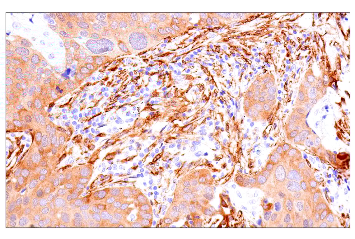 Immunohistochemistry Image 2: Phospho-YAP (Ser61) (E4Q8S) Rabbit mAb