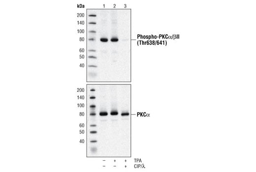 Western Blotting Image 2: Phospho-PKCα/β II (Thr638/641) Antibody