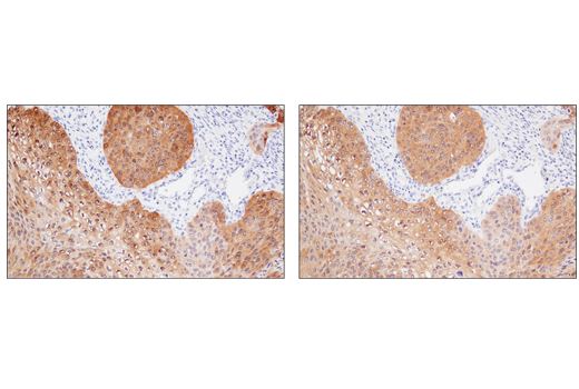 Immunohistochemistry Image 4: MAGE-A4 (E7O1U) XP<sup>®</sup> Rabbit mAb