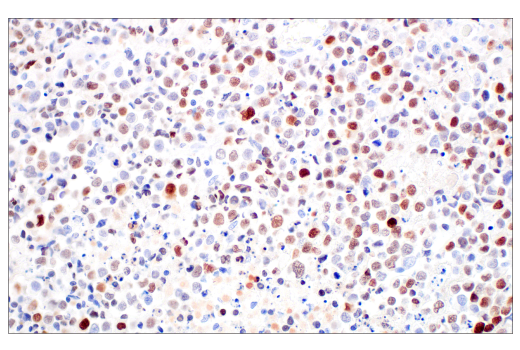 Immunohistochemistry Image 4: POU2F3 (E5N2D) XP<sup>®</sup> Rabbit mAb