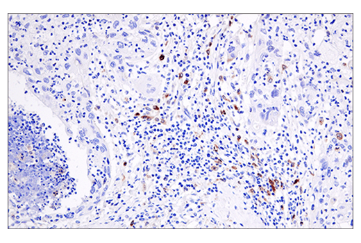 undefined Image 34: Human Reactive PANoptosis Antibody Sampler Kit