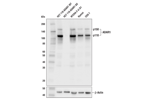 Western Blotting Image 1: ADAR1 (E6X9R) XP® Rabbit mAb