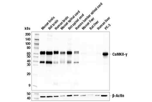 Western Blotting Image 1: CaMKII-γ (E4C3O) Rabbit mAb