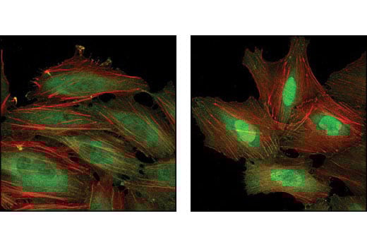 Immunofluorescence Image 1: Anti-rat IgG (H+L), (Alexa Fluor<sup>®</sup> 488 Conjugate)