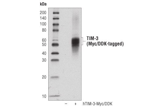 undefined Image 83: Human Exhausted CD8<sup>+</sup> T Cell IHC Antibody Sampler Kit