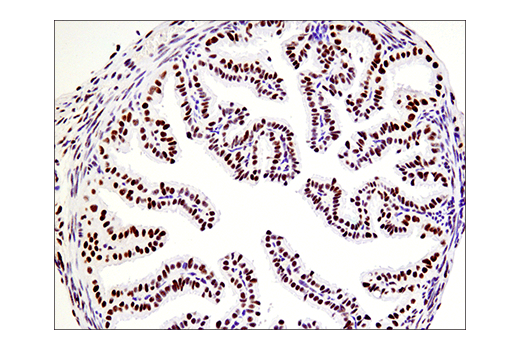 Immunohistochemistry Image 6: Phospho-ATF-2 (Thr71)/ATF-7 (Thr53) (E4A5G) XP<sup>®</sup> Rabbit mAb