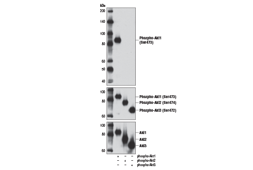 undefined Image 33: Phospho-Akt Isoform Antibody Sampler Kit