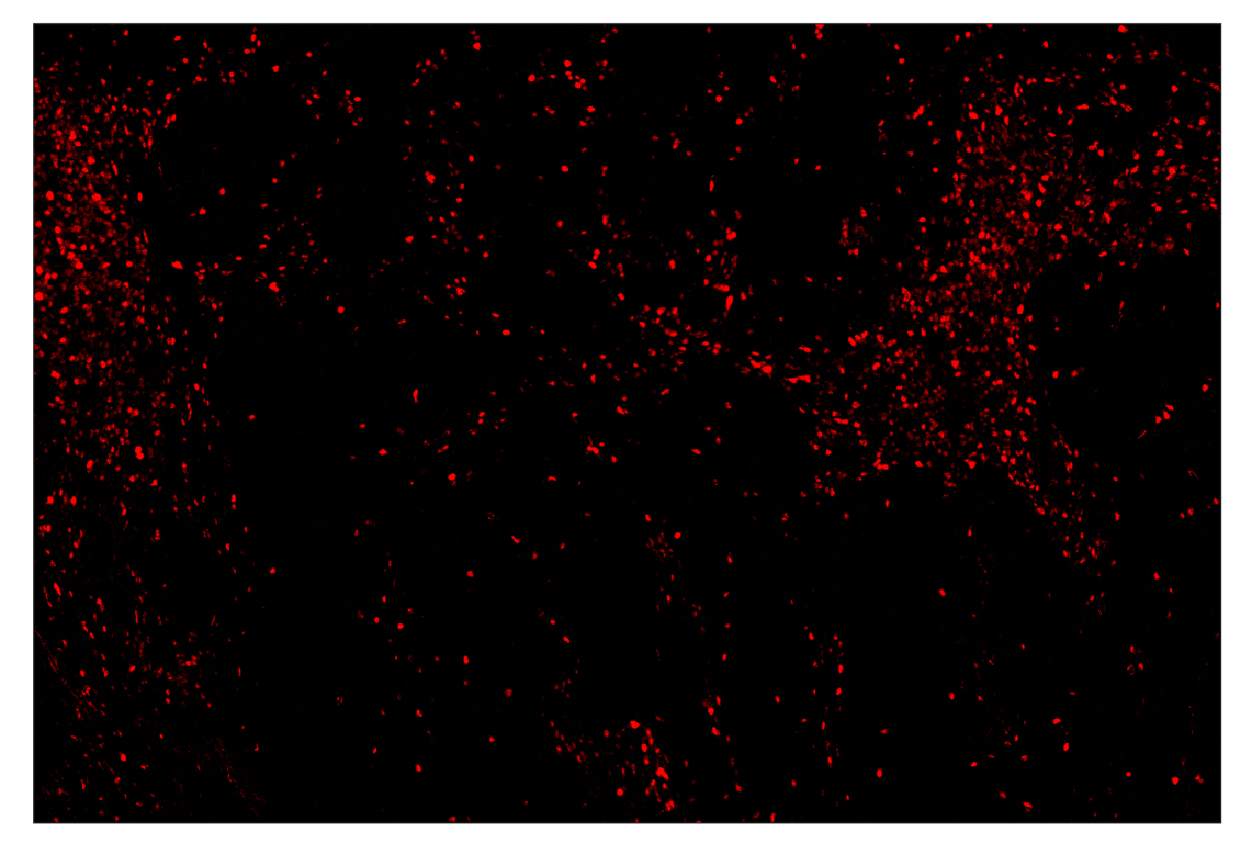 Immunohistochemistry Image 3: T-bet/TBX21 (E4I2K) & CO-0077-488 SignalStar<sup>™</sup> Oligo-Antibody Pair