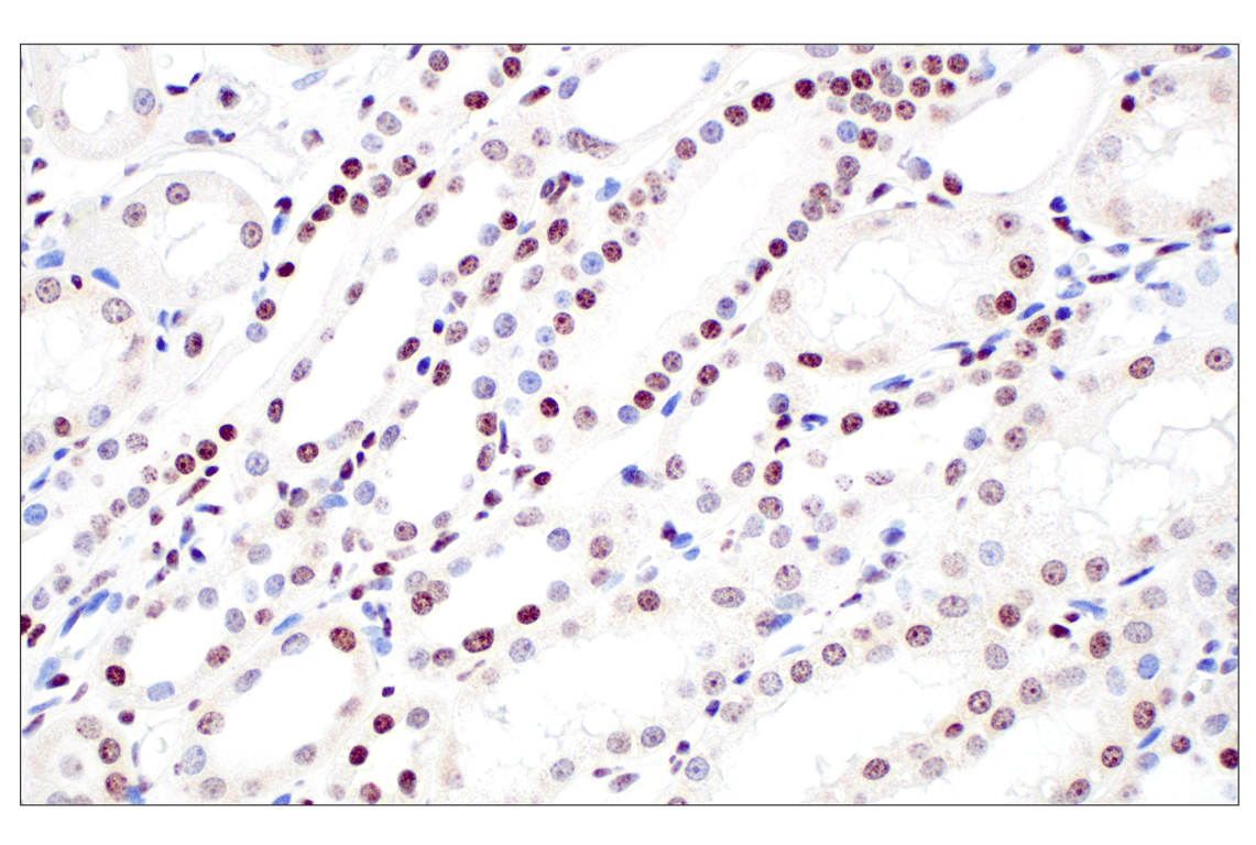 Immunohistochemistry Image 5: Tri-Methyl-Histone H3 (Lys27) (C36B11) Rabbit mAb