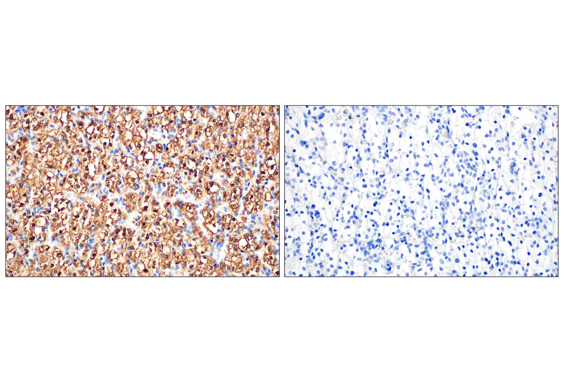Immunohistochemistry Image 15: Perilipin-2 (E6G6M) Rabbit mAb