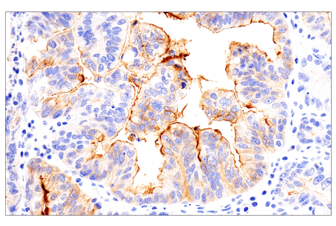 Immunohistochemistry Image 2: Folate Receptor Alpha/FOLR1 (BN3.2) Mouse mAb