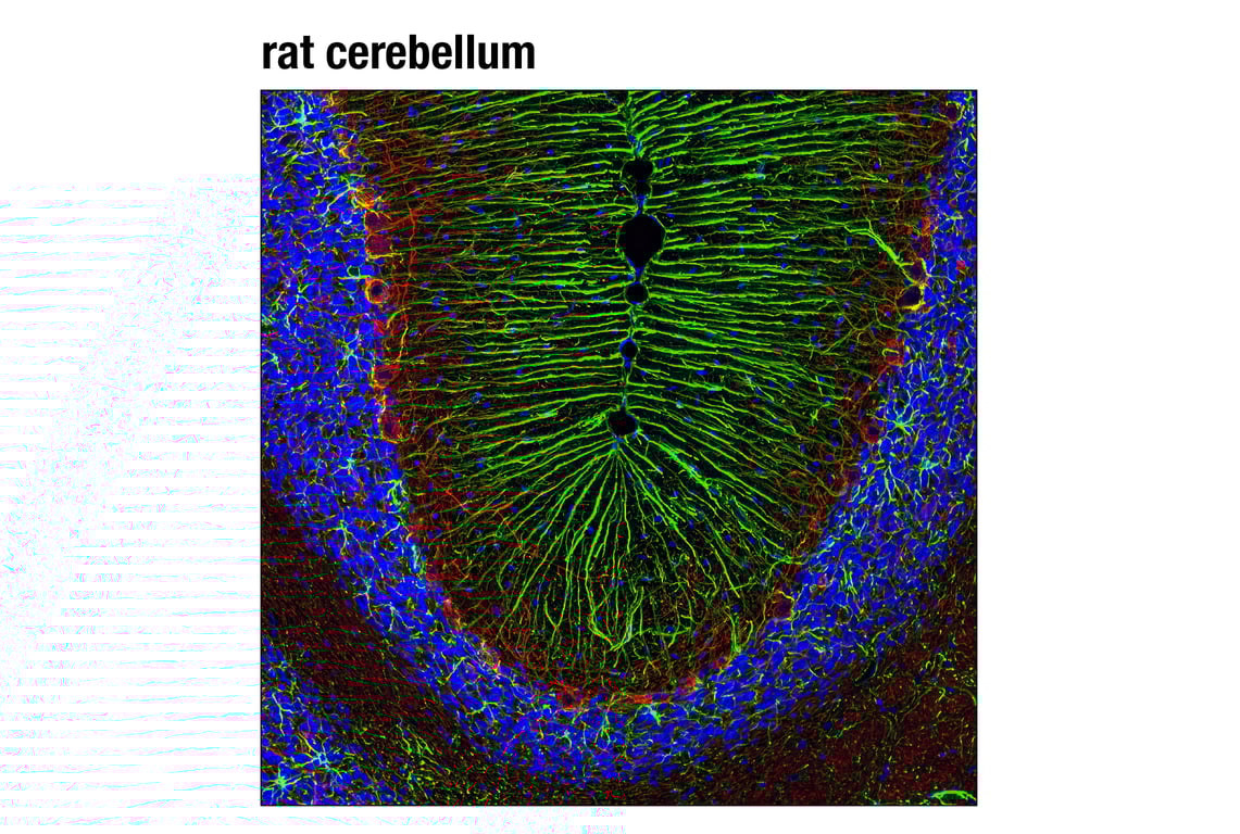 Immunofluorescence Image 1: GFAP (D1F4Q) XP<sup>®</sup> Rabbit mAb
